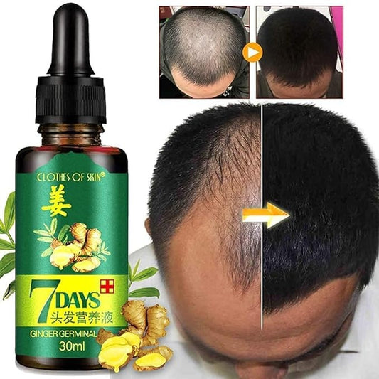 Hair Regrow Ginger Essential Oil – 7 Day Hair Growth & Hair Loss Serum for Men & Women (30ml)